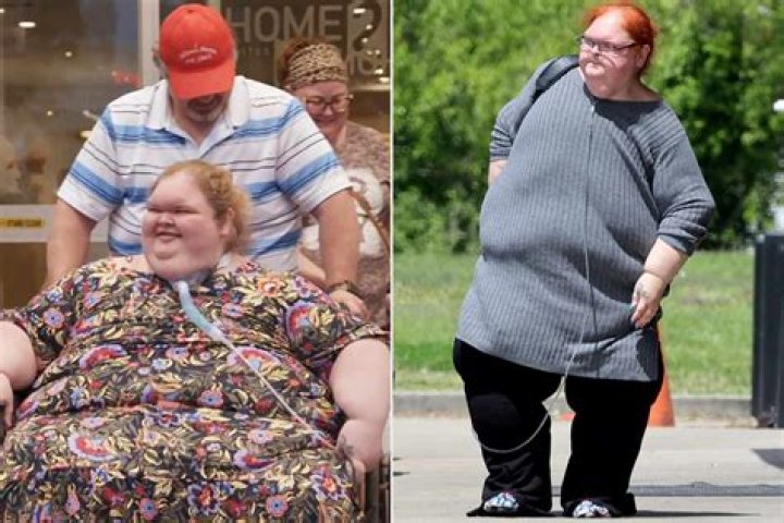 Casey King’s Amazing Weight Loss Journey From 845 lbs to 266 Lbs!