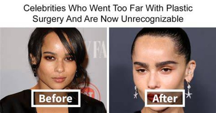 Constance Nunes’ Glam Seems All Plastic Surgery!