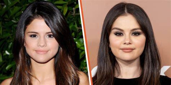 Did Amanda Batula Get A Nose Job? Before And After Photos Explored