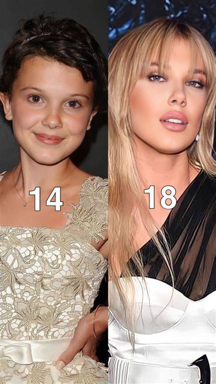 Did Millie Bobby Brown Got Botox? Her Face Surgery Before And Photos & Nose Job Explored