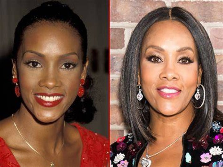 Did Vivica Fox Have a BBL? Or Any Other Plastic Surgery?