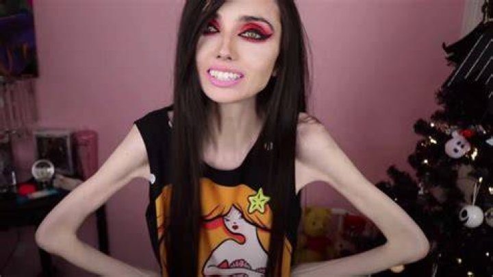 Eugenia Cooney Before Weight Loss: What is Wrong With Her?