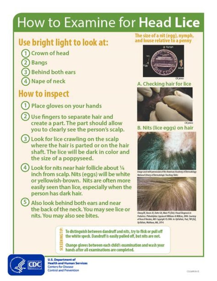 How to Get Rid of Head Lice in Nigeria