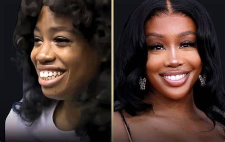 How Was SZA Before Surgery? Her Before And After Pictures Analyzed