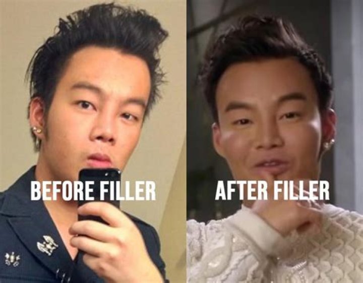 Kane Bling Empire Before Plastic Surgery Photos Compared To After -How Much Did He Change