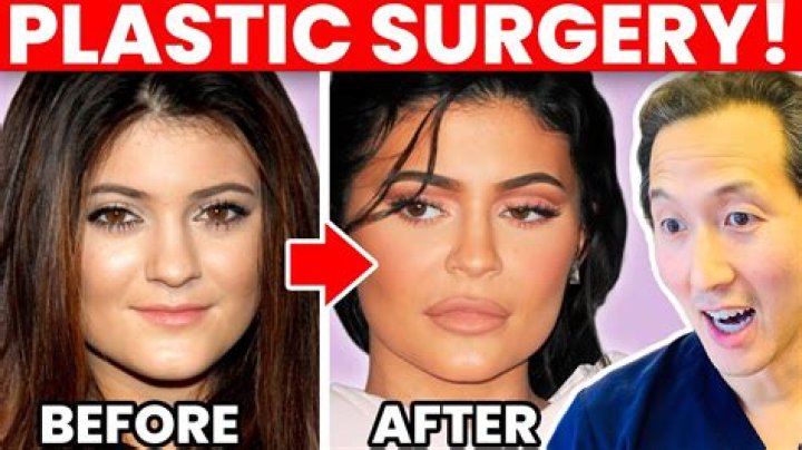 Mimi Keene Plastic Surgery: Has She Had a Boob Job?