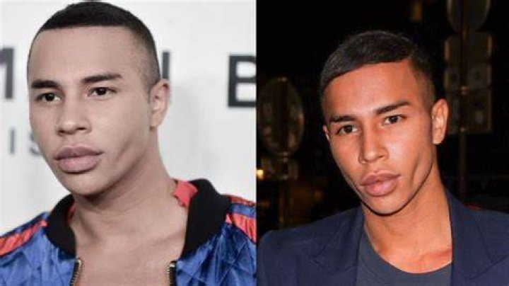 Olivier Rousteing Partner: Did He Have A Plastic Surgery? Details To Follow