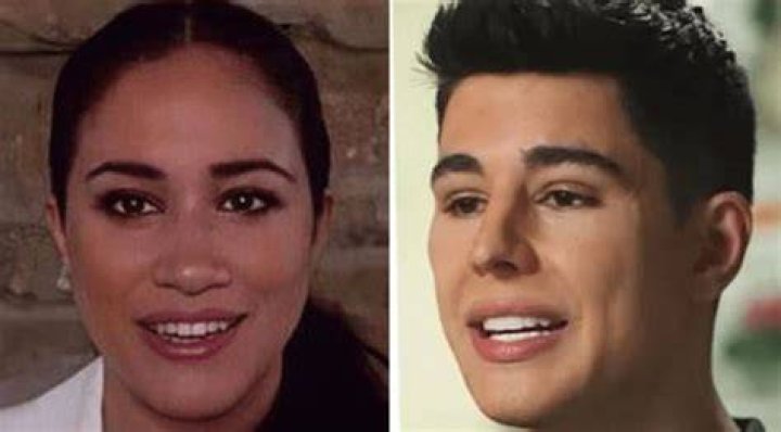 Omid Scobie Plastic Surgery: Before and After Photo