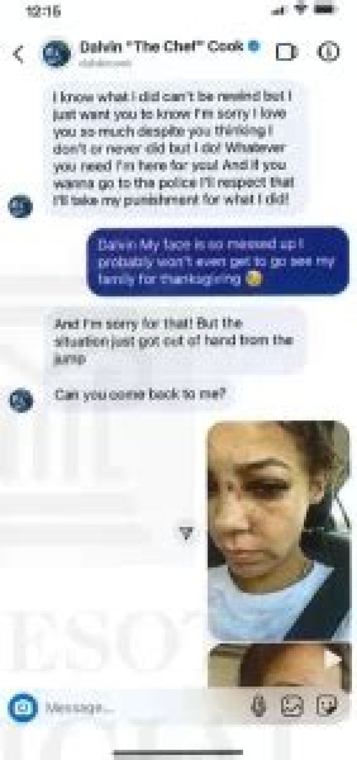 Photos: Dalvin Cook Ex Girlfriend Gracelyn Trimble – Domestic Violence Charges Amid Arrest Rumors