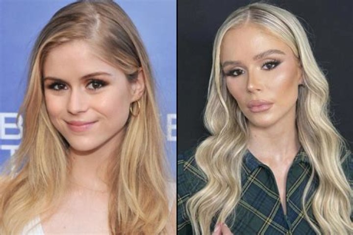 Photos: Johanna Leia Plastic Surgery – Before and After: Her Baby Daddy And Ethnicity Exposed
