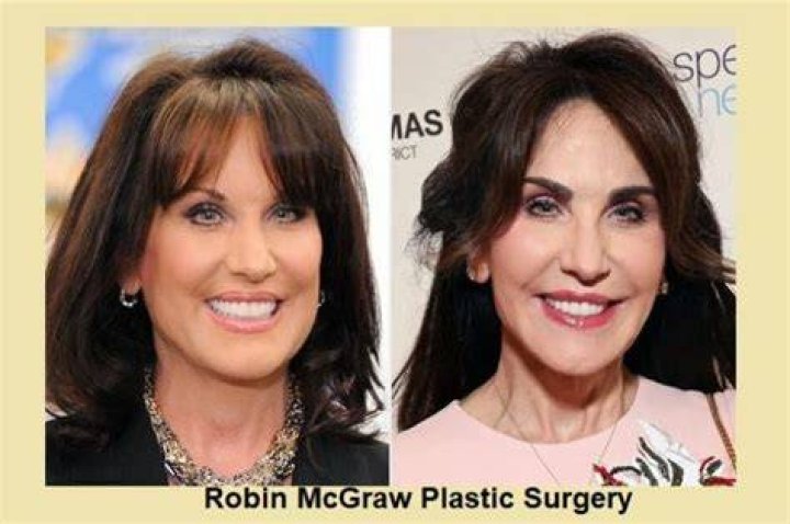 Photos: What Is Tim Mcgraw Plastic Surgery Story? Before And After Transformation Pictures Exposed