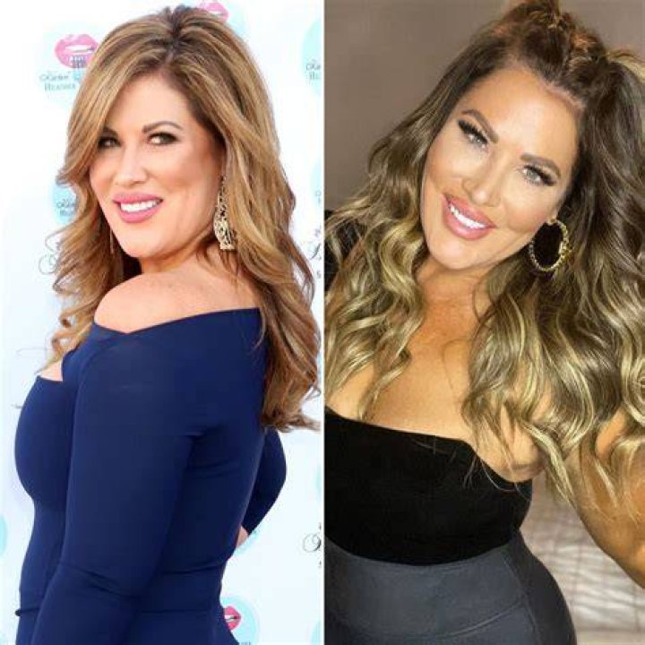 RHOC: Nicole Weiss Before Surgery – How Did She Look? Young Photos