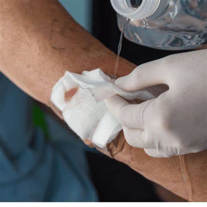Should i remove gauze stuck to wound