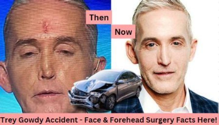 Trey Gowdy Health Problems & Accident -What Happened To His Nose And Face? Everything To Know