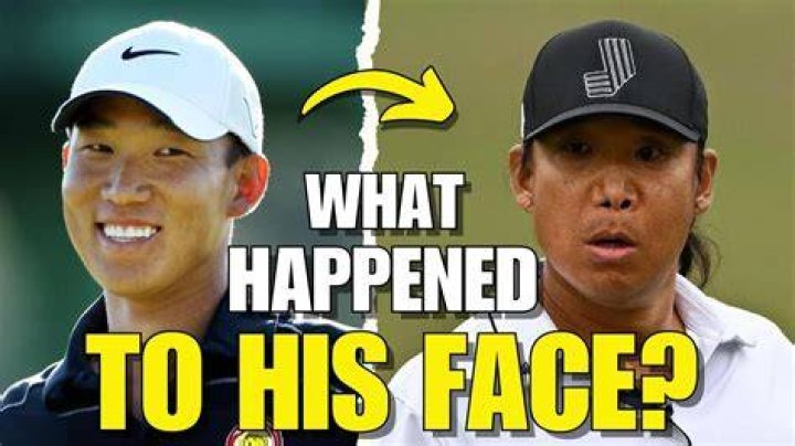 What Happened To Anthony Kim The Golfer, Where Is He Now?