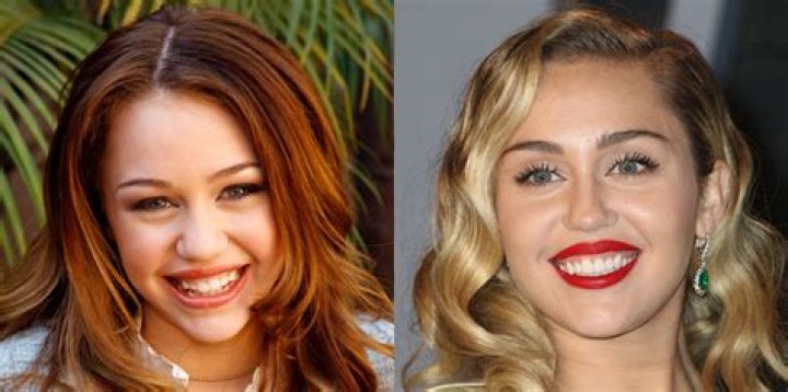 What’s Wrong With Gabi Butler Teeth? Before And After Fixing – Cheer