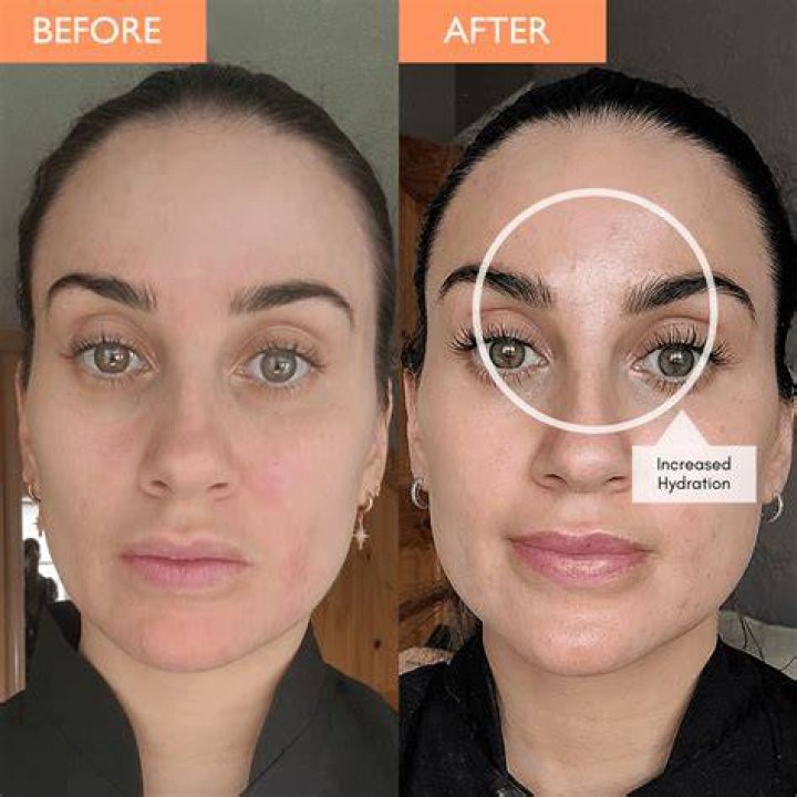 YouTuber: What Happened to Nikki Lilly Face? – Before And After Photos